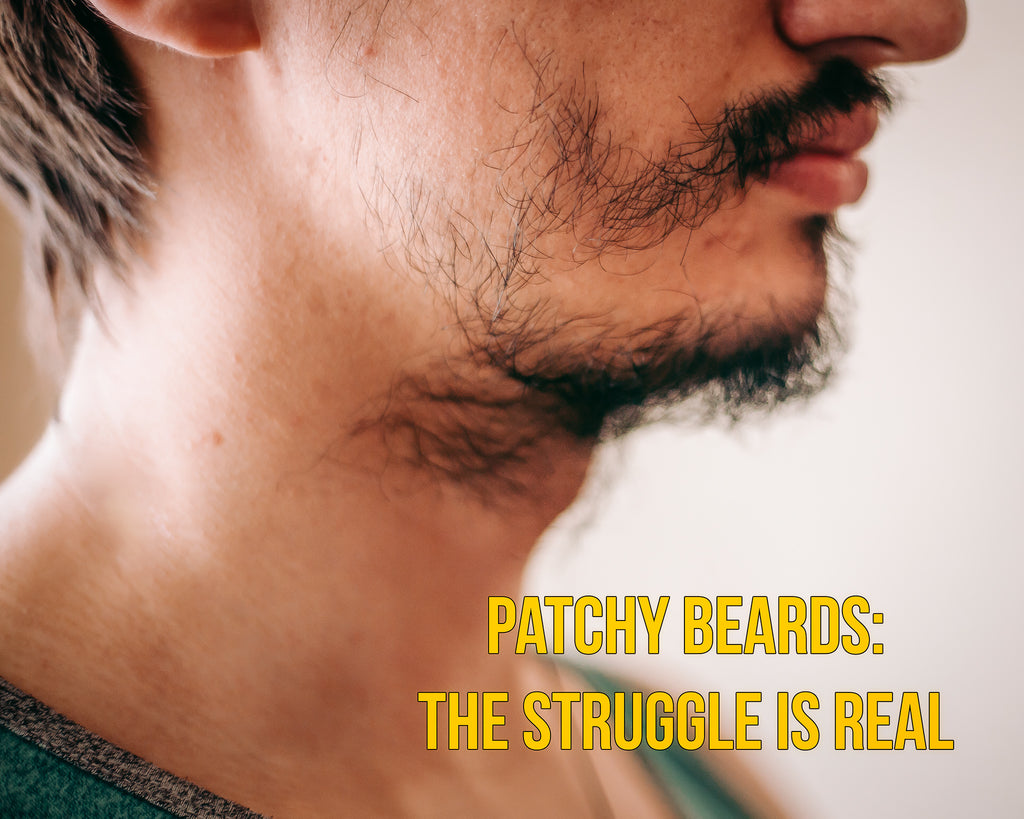 Patchy Beard How To Fix A Patchy Beard