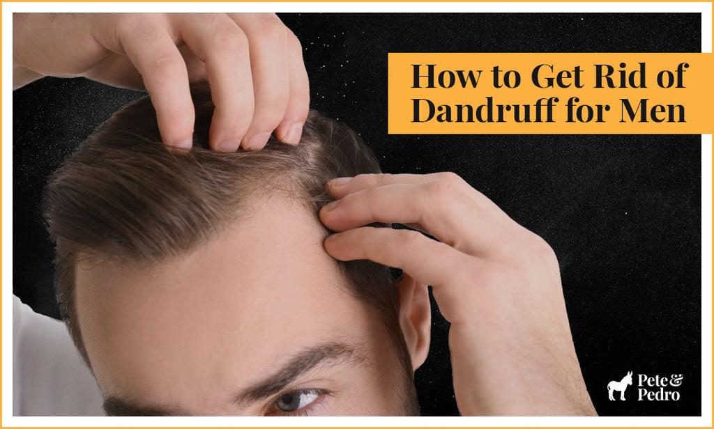 How to Get Rid of Dandruff for Men
