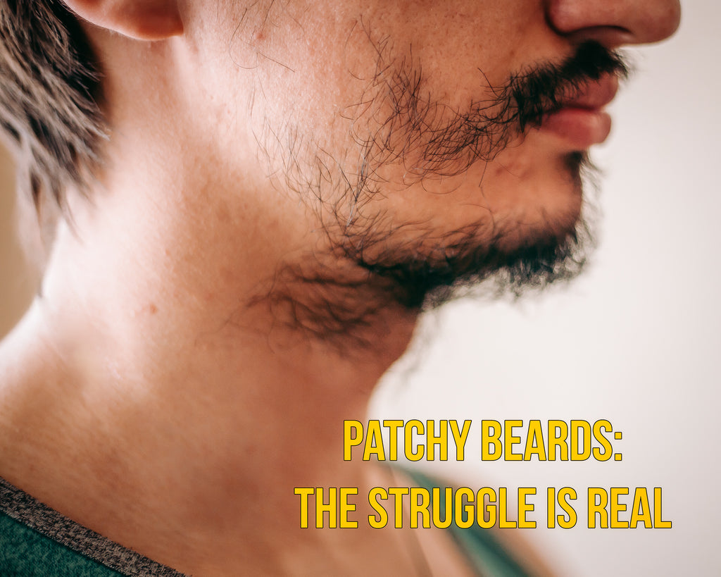 How To Fix A Patchy Beard: Tips To Get A Full Beard