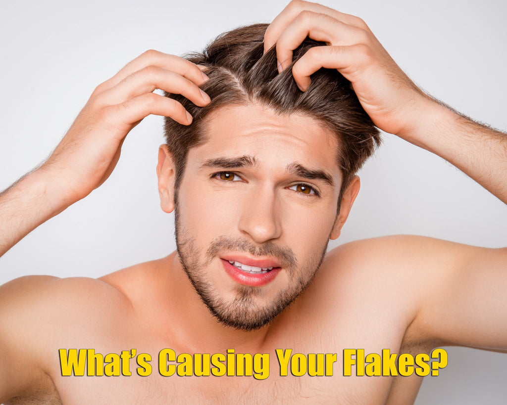 What Is The Difference Between Dandruff vs. Dry Scalp