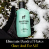 control anti itch dandruff shampoo key benefits