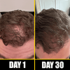 Before and after comparison of hair growth over 30 days on a person's head.