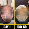 Before and after comparison of hair growth on a person's head over 60 days.
