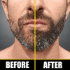 hair beard growth biotin rosemary serum oil before after hair transformation comparison