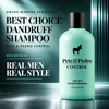 control anti-itch anti-dandruff coal tar shampoo real men real style award winner